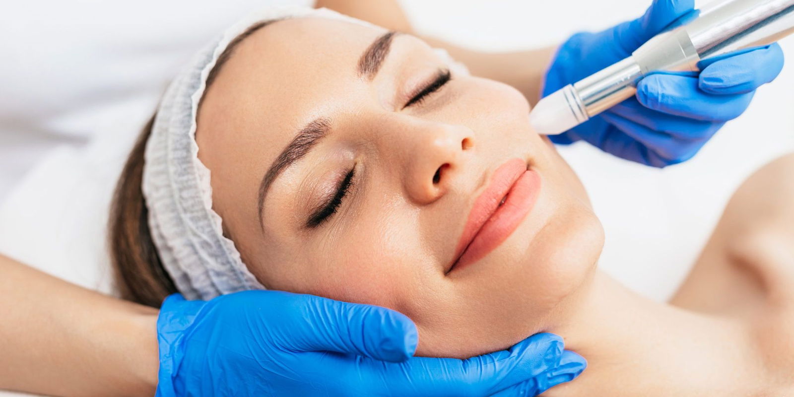 Benefits of PRP Laser Resurfacing & PRP Microneedling